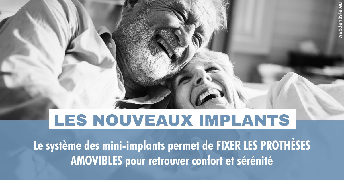 https://dr-laurent-sers.chirurgiens-dentistes.fr/Les nouveaux implants 2