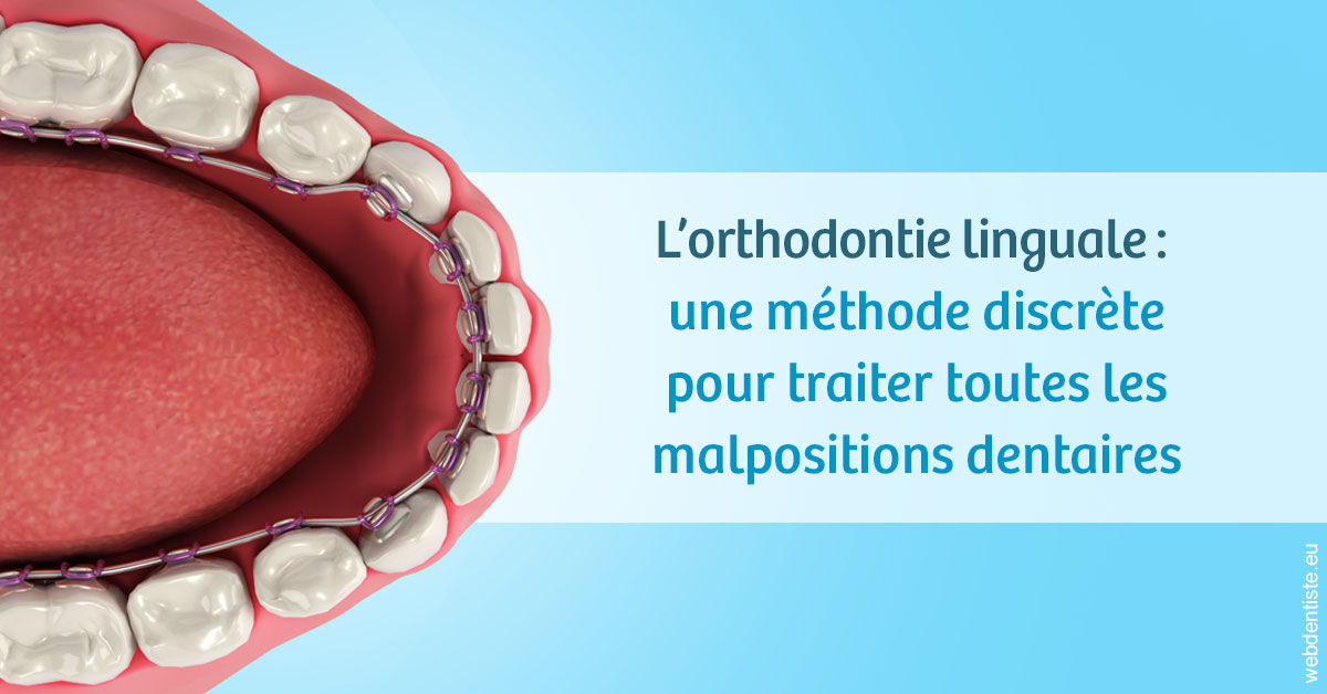 https://dr-laurent-sers.chirurgiens-dentistes.fr/L'orthodontie linguale 1
