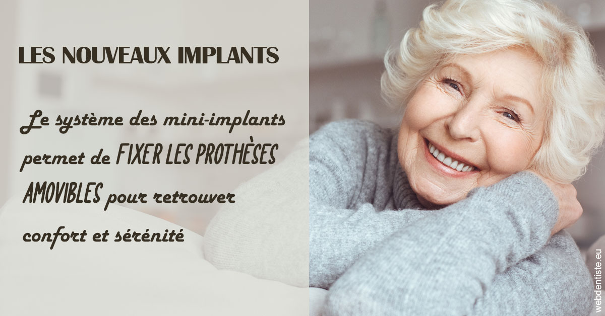 https://dr-laurent-sers.chirurgiens-dentistes.fr/Les nouveaux implants 1