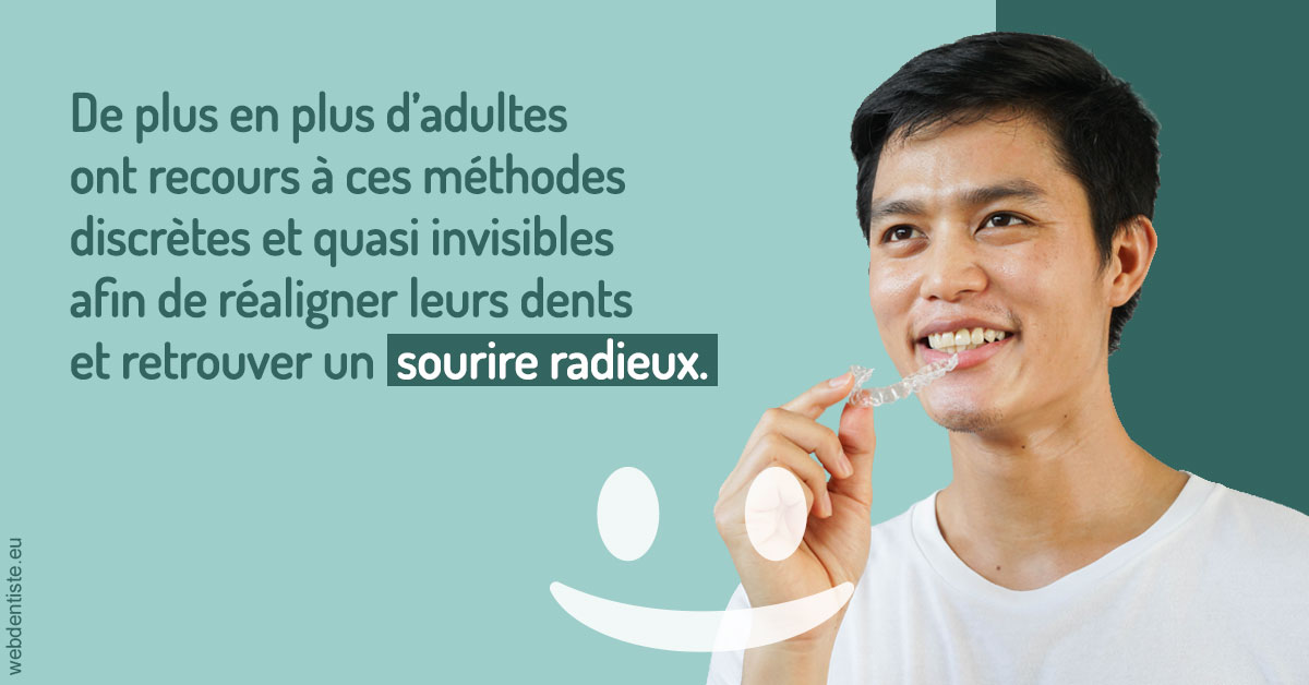 https://dr-laurent-sers.chirurgiens-dentistes.fr/Gouttières sourire radieux 2