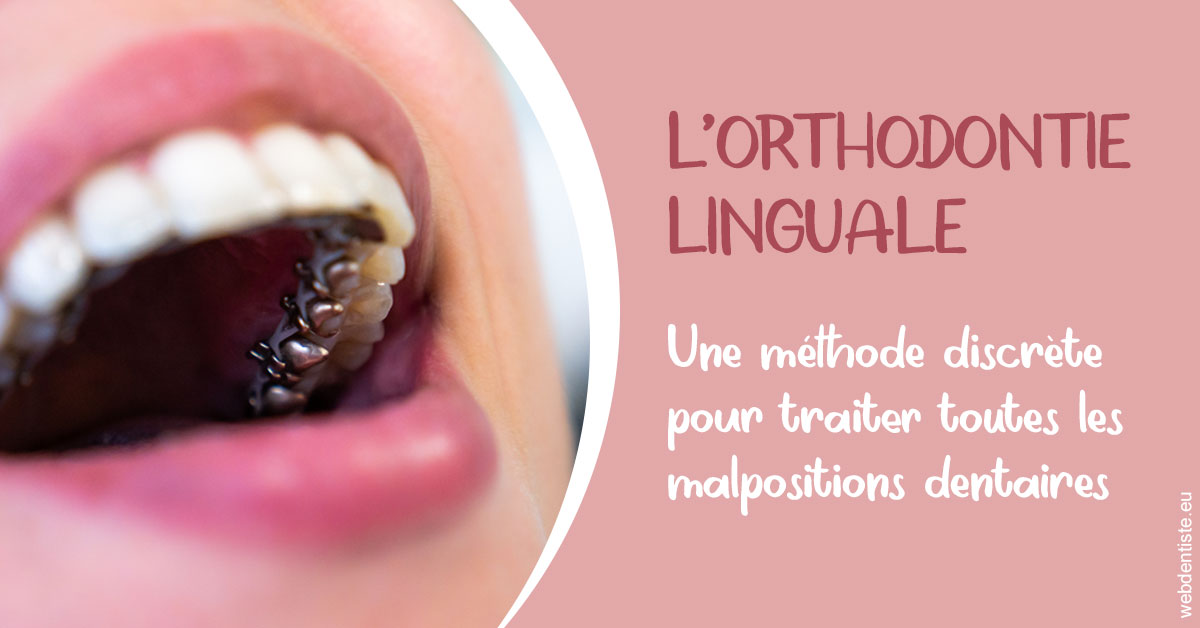 https://dr-laurent-sers.chirurgiens-dentistes.fr/L'orthodontie linguale 2