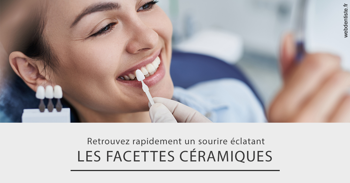 https://dr-laurent-sers.chirurgiens-dentistes.fr/Les facettes céramiques 2