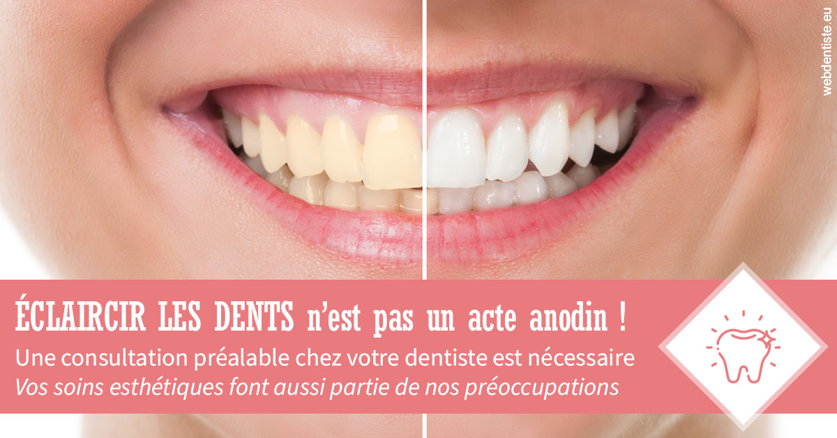 https://dr-laurent-sers.chirurgiens-dentistes.fr/Eclaircir les dents 1