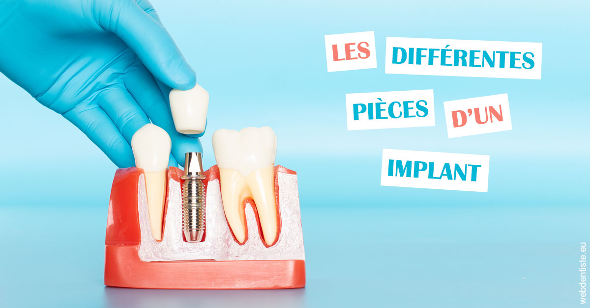 https://dr-laurent-sers.chirurgiens-dentistes.fr/Les différentes pièces d’un implant 2