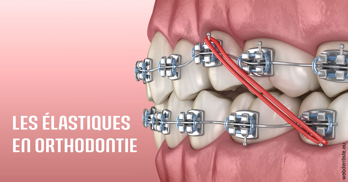 https://dr-laurent-sers.chirurgiens-dentistes.fr/Elastiques orthodontie 2