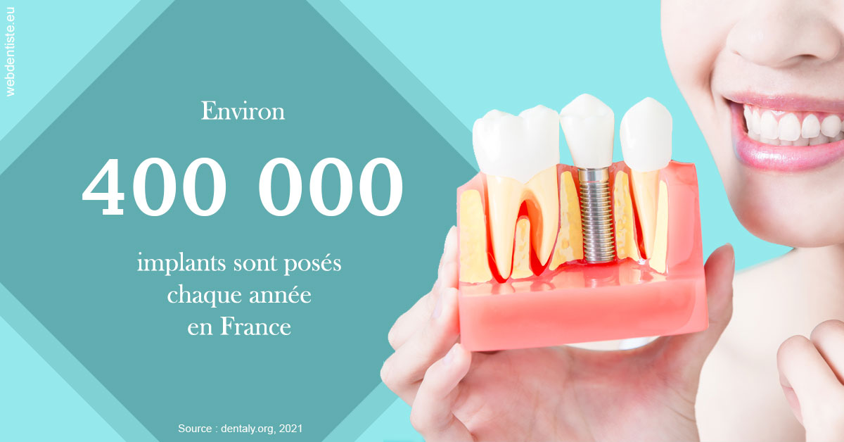 https://dr-laurent-sers.chirurgiens-dentistes.fr/Pose d'implants en France 2
