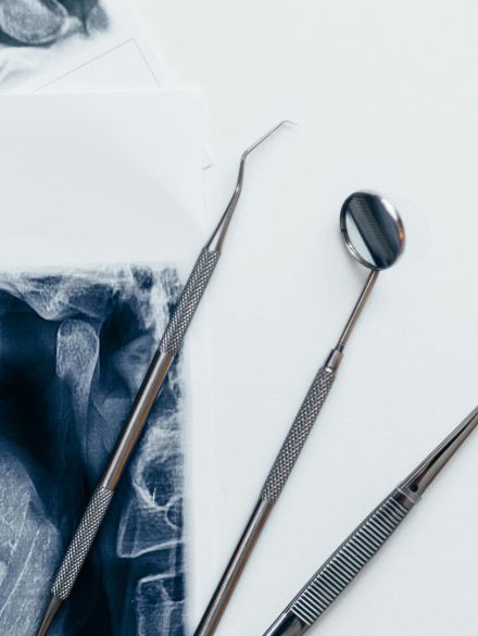 Guided Surgery Dr Laurent SERS Cannes (4)